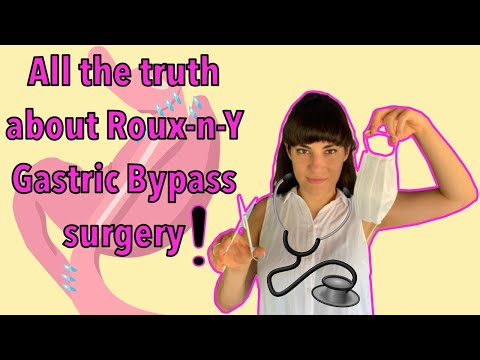 10-facts-that-you-must-know-before-you-do-roux--n-y-gastric-bypass-surgery