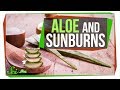 Does aloe really treat a sunburn