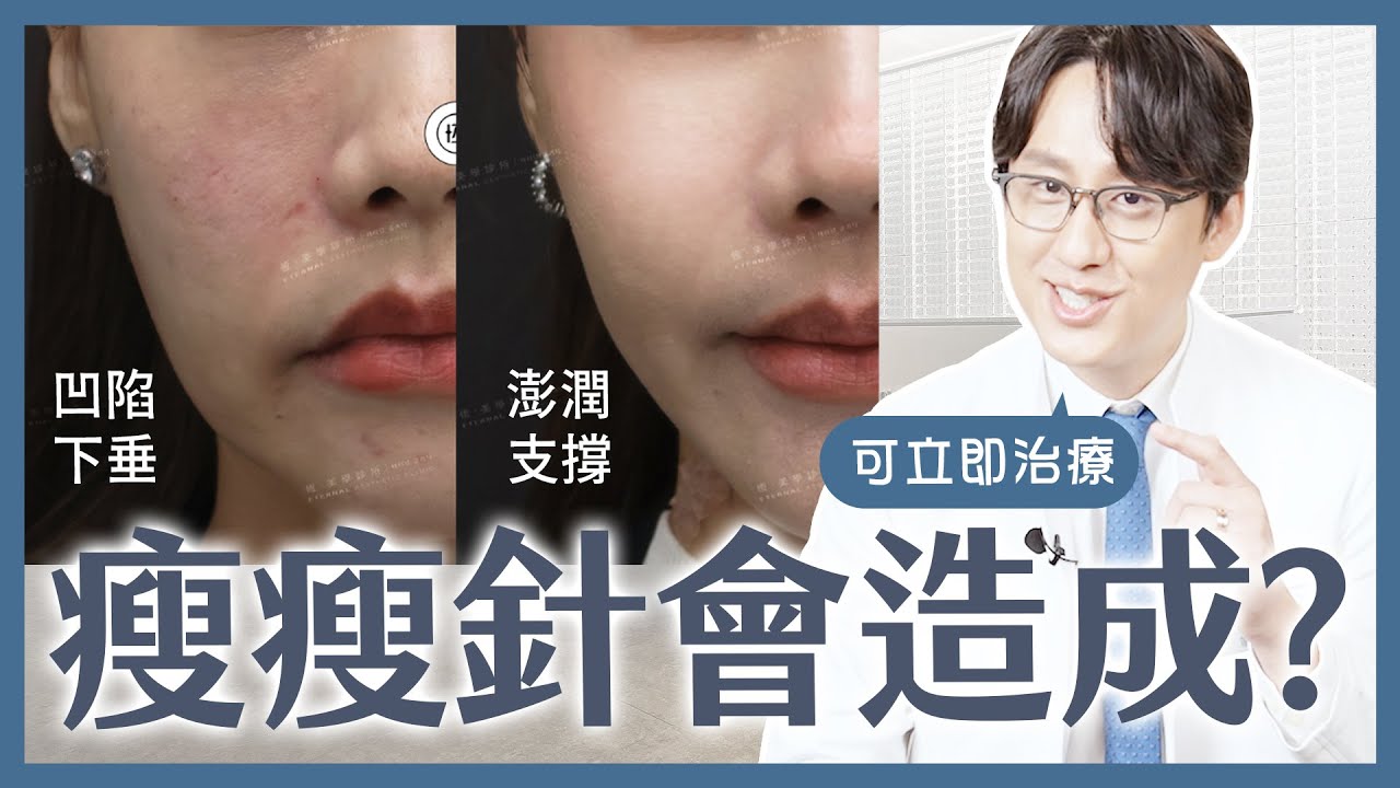 爆紅瘦瘦針暗藏容貌危機💥歐巴醫師詳解「瘦老臉」修復對策