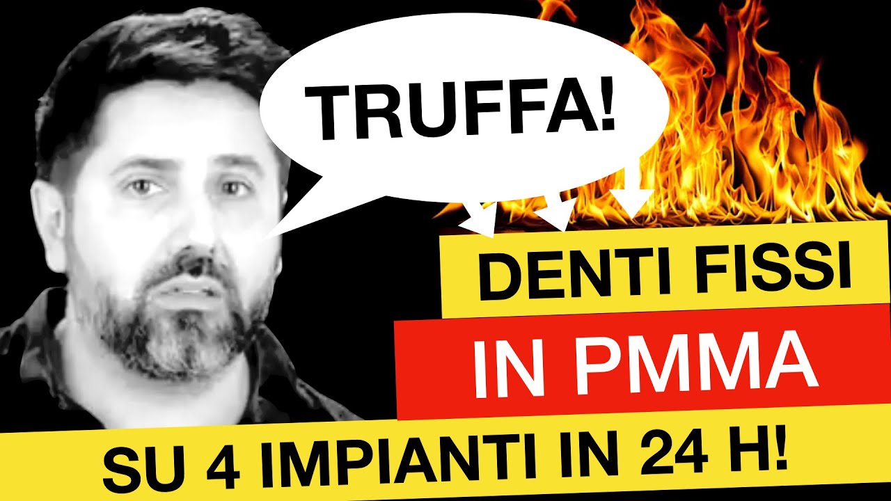 TRUFFA: Denti fissi su 4 impianti in 24/h in PMMA!?