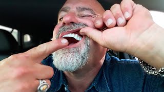5 reasons why I stopped regretting dental implants