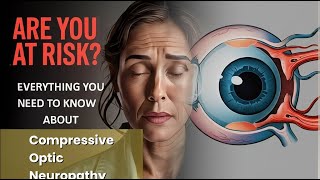Compressive Optic Neuropathy Explained Causes, Symptoms and Treatment, All Insights