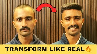 Hair Patch for Men | Non Surgical Hair Fixing | Low Density Hair Patch