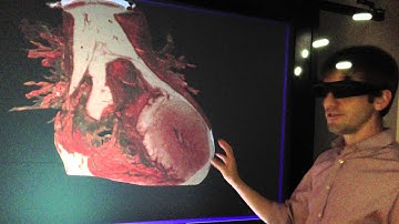 Virtual Prototyping of Medical Devices