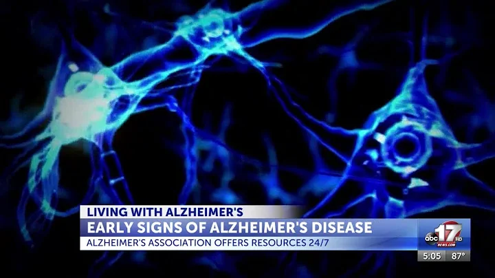 Walks set to raise money, awareness for fight against Alzheimer's in Mid-Missouri