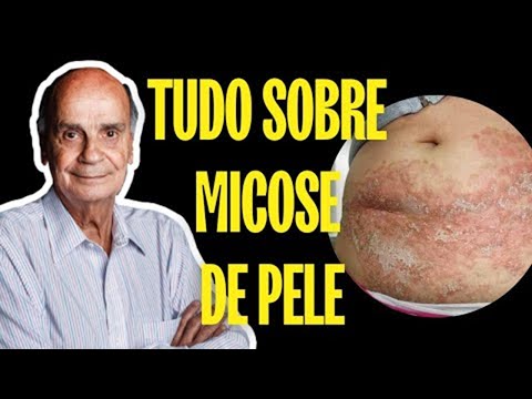 MICOSE DE PELE - TUDO QUE VOCÊ PRECISA SABER SOBRE ESSA DOENÇA [VEJA O VÍDEO!]