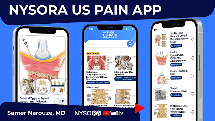 NYSORA RELEASES ULTRASOUND-GUIDE...  PAIN APP!