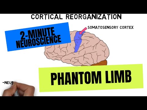 2-Minute Neuroscience: Phantom Limb