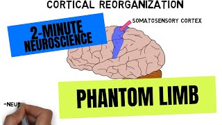 2-Minute Neuroscience: Phantom Limb