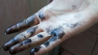 Eli̇mi̇ze Bulaşan Mürekkep Lekesi̇ Nasil Çikar? How To Clean Ink Stain From Our Hands Easi̇ly