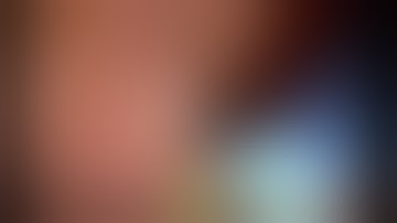 Technique of digital cholangioscopy for examination of the common bile duct - Mohamed Othman M.D.