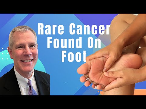 Rare Foot Cancer, Diagnosis, Treatment & Motivation for Living Life with Terry Tucker & James Mille