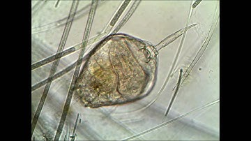 Rotifer Video taken at 1024 x 768 with Tucsen microscope camera using MICAM