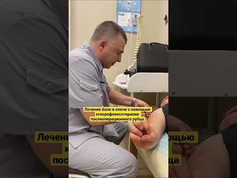 Травматолог-ортопед Мирошников Д.Л. #иглорефлексотерапиякраснодар #лечениеболикраснодар #краснодар