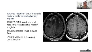 Multidisciplinary Care of Patients with Brain Metastases in the Era of Precision Medicine