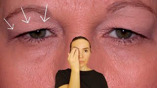 Fix droopy eyelids | How to tighten droopy eyelids