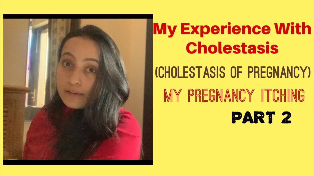My Experience with Cholestasis of Pregnancy (itching in Pregnancy) PART