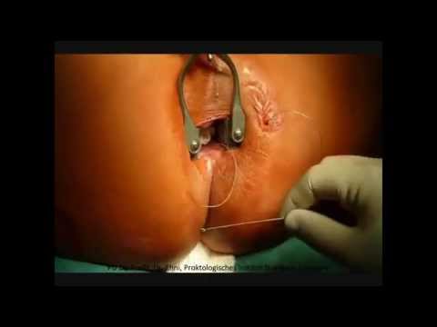 Innocent arab girls fuck Hyderabad college girls triple x sex