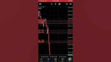 Buy or Sell? Price Action Strategy #forextrading  #forexscalping  #xauusd