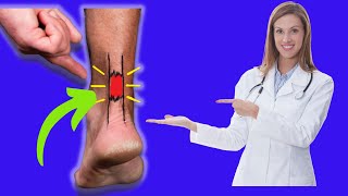 How to Tell if You&#39;ve TORN Your Achilles Tendon!