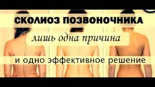 Сколиоз позвоночника. Как лечить у взрослых и детей. Сколиоз позвоночника. Как лечить у взрослых и детей.