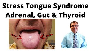 Stress Tongue Syndrome Adrenal, Gut \u0026 Thyroid