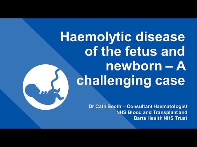 London RTC Education Session - Haemolytic disease of fetus and newborn - A challenging case class=