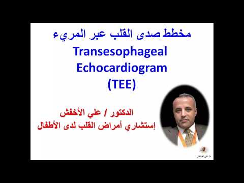 Trans-esophageal Electrocardiography (TEE) -- تصوير صدى القلب عبر المريء