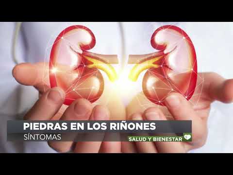 Sintomas piedras en los rinones hombres