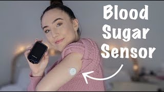 ♡ How I Place My Blood Sugar Sensor/Monitor! | Amy Lee Fisher ♡