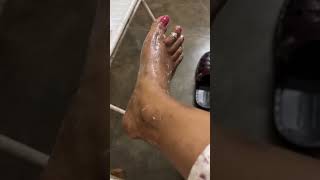 Travel ki wajhe se pairo ki halt bohat khrab ho gai thi #minivlog #explorepage #meeshohaul