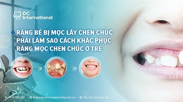 Răng Bé Bị Mọc Lẫy( Chen Chúc) Phải Làm Sao? Cách Khắc Phục Răng Mọc Chen Chúc Ở Trẻ Dr Cường