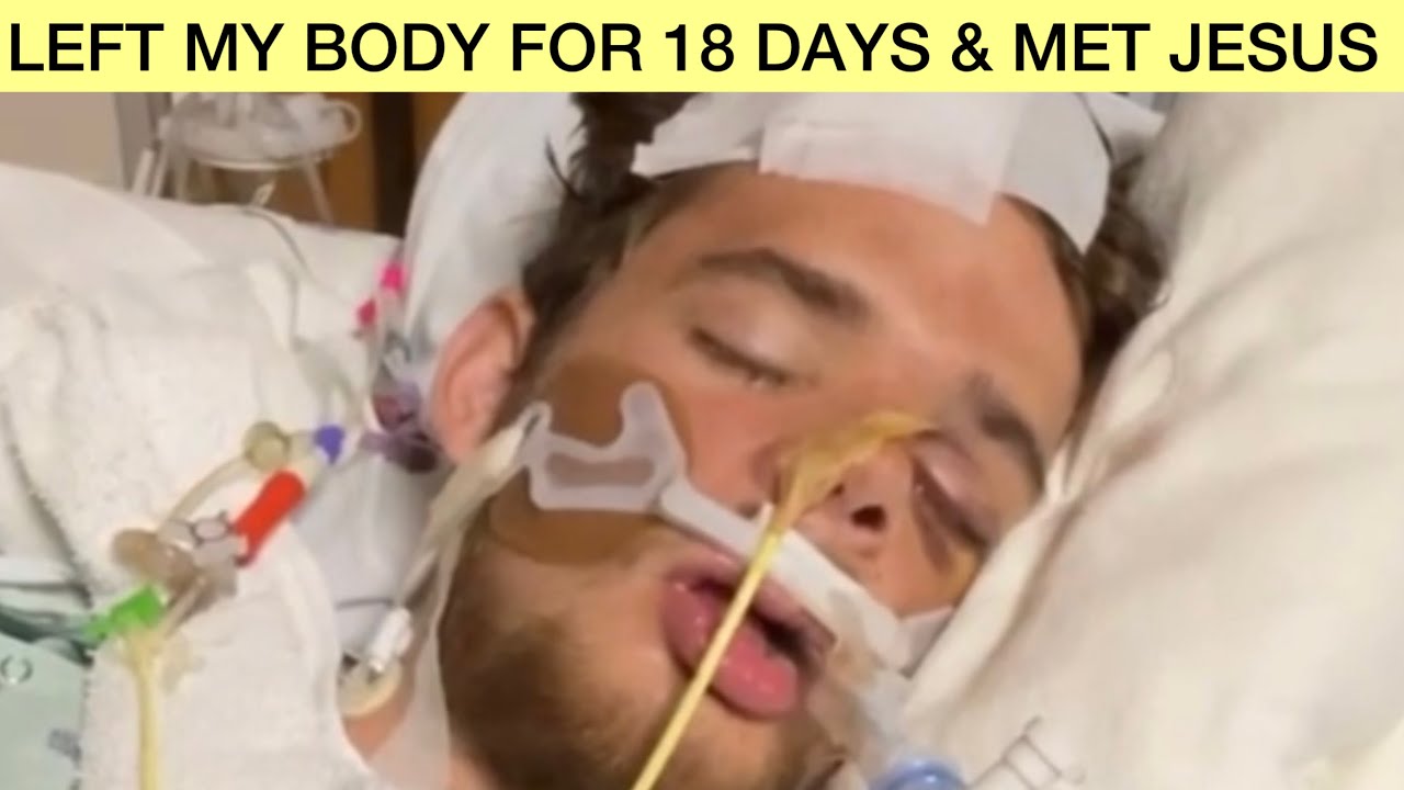 Comatose For 18 Days, & JESUS showed me This STUNNING Truth In Heaven