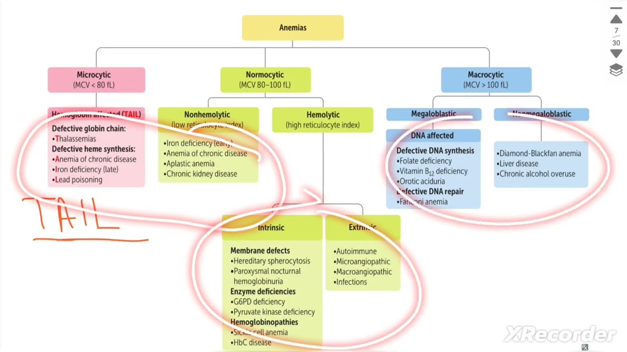 ANEMIYALAR KLASSIFIKATSIYASI | TEMIR TANQISLIGI ANEMIYASI