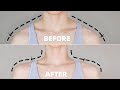 (Eng) Perfect Posture Challenge! | Fix Rounded Shoulders &amp; Hunchback Posture in 2 WEEKS