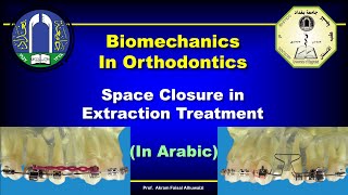 Space closure in Extraction Therapy (In Arabic)