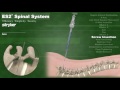 ES2® Percutaneous Spinal System for Minimally Invasive Procedures