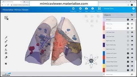 How to View Cases in Mimics Viewer | Materialise Mimics 22