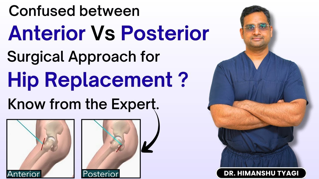 Anterior Vs Posterior Surgical Approach for hip replacement ? Know from ...