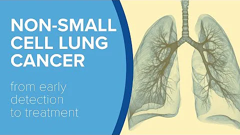 Non-Small Cell Lung Cancer - Yale Medicine Explains