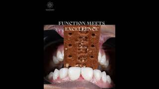 How Dr. Jaydev Dental Determines Perfect Veneer Length | Smile Design Process Explained
