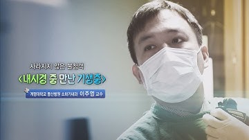 내시경 중 만난 기생충 - 계명대 동산병원 소화기내과 이주엽 교수 - 2