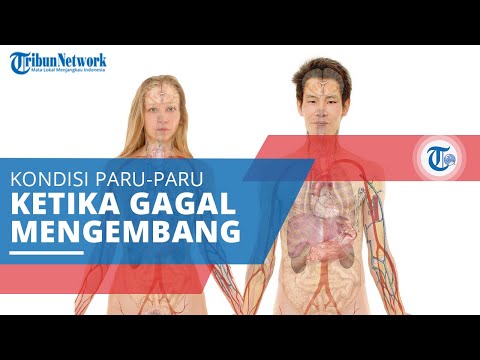 Atelektasis, Suatu Kondisi ketika Paru-paru Gagal atau Tidak Dapat Mengembang Sempurna