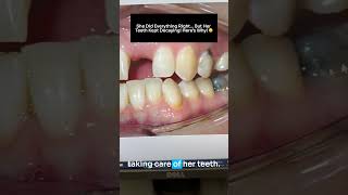 She Did Everything Right But Her Teeth Kept Decaying Heres Why