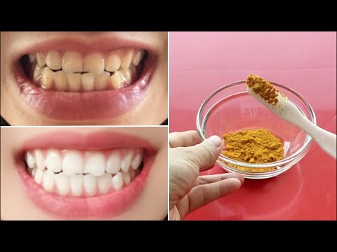 薑黃粉加兩物  自製美白牙粉和牙膏 How to Make Teeth Whitening Powder; DIY