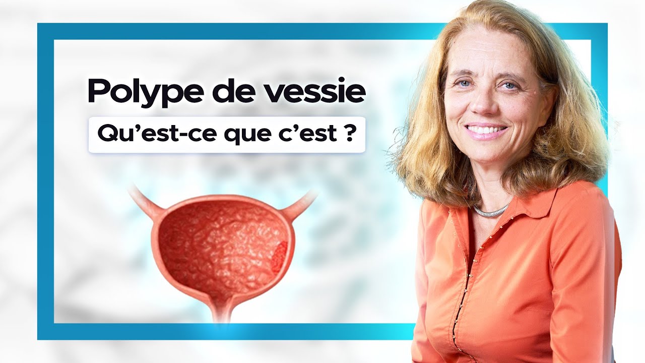 Mon avis en vidéo