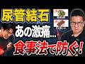 【実は危険】尿管結石を防ぐ食事方法とは?実は結石になりやすい人の共通点!!