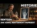 🎧Příběh rentgenu – Paprsky, které odhalily lidské kosti bez jediného řezu