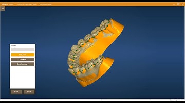 INTEWARE SPLINT DESIGN TUTORIAL