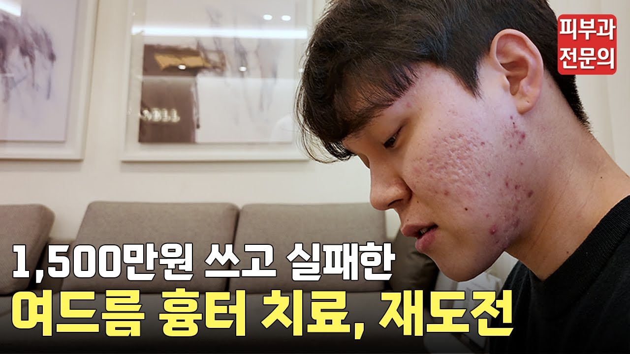 여드름 흉터, 절망에서 희망으로 바뀐 리얼 후기ㅣ동대문 피부과, 청량리 피부과, 흉터전문 피부과, 흉터 치료, 여드름 흉터, 여드름 흉터 레이저